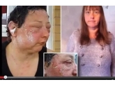 年底染发千万要注意!有女生过敏变"突眼金鱼",严重还会致死! 年底染发千万要注意!有女生过敏变"突眼金鱼",严重还会致死!
